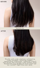 scalp solutions exfoliating scalp treatment